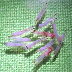 Hajátültetés, hajbeültetés, FUE, hajimplantáció, hajtranszplantáció, hajáthelyezés, graft, hajvonal, beültetés, implantáció
